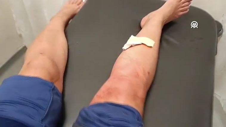 Bu tehlikeye kim dur diyecek! Sokak köpekleri sahilde yürüyen kadına saldırdı - Resim: 10